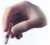 images/Dermabond_image_1.jpg
